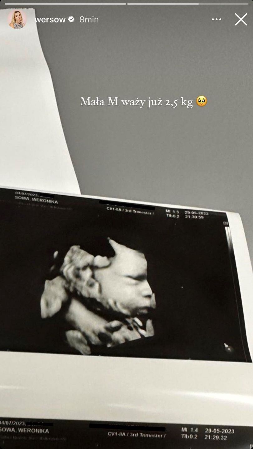 Twarz córki Wersow i Friza na zdjęciu USG