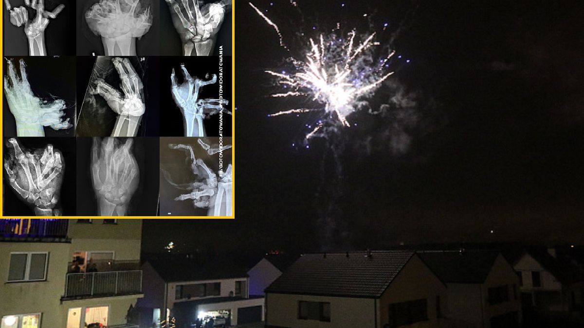 Ratownicy przestrzegają przed używaniem fajerwerków 