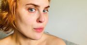 Córka Bruce'a Willisa pozbyła się wypełniaczy w twarzy. "Bałam się wspomnieć"