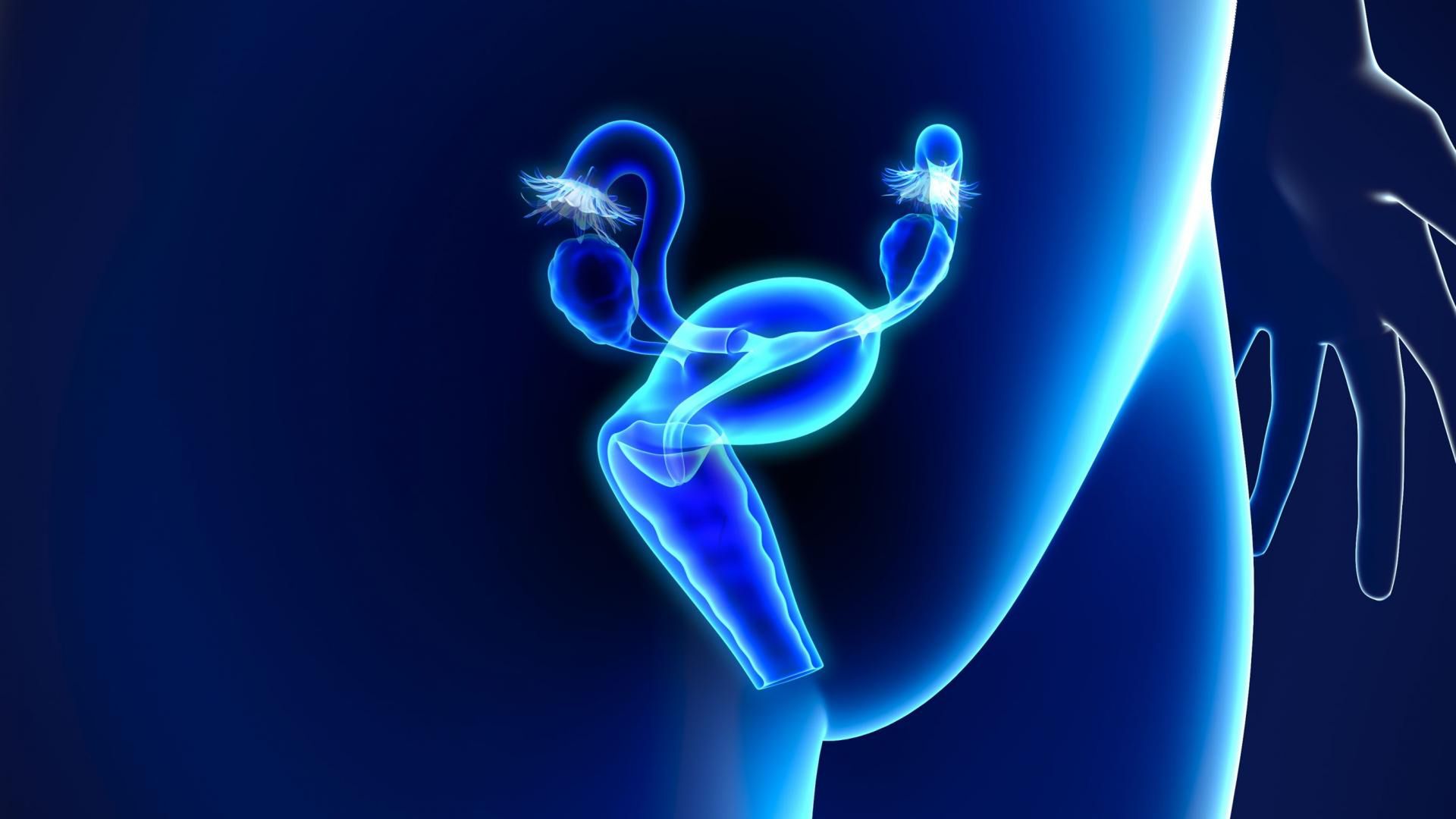 Mięśniaki macicy da się wyleczyć.