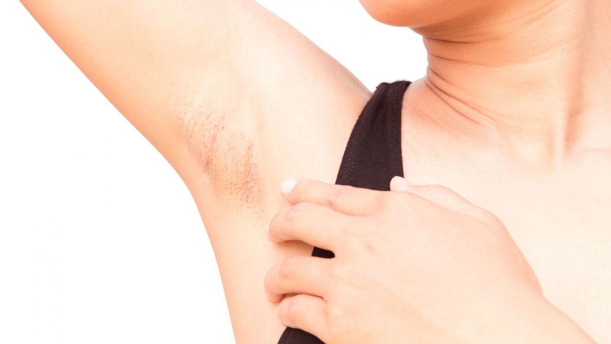 Ból pod pachą [123rf.com]