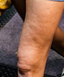 Cameron Diaz: Jakie straszne nogi! Co się stało pięknej aktorce?