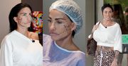 Zadłużona na ponad 3 miliony złotych Katie Price poddaje się szóstemu (!) liftingowi twarzy w Turcji (ZDJĘCIA)