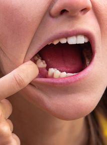 Stracone zęby odrosną? Ruszają badania na ludziach