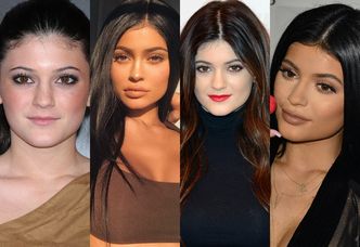 Od "brzydkiej siostry" do największej gwiazdy w rodzinie: Kylie Jenner kończy dzisiaj... 20 lat! (DUŻO ZDJĘĆ)