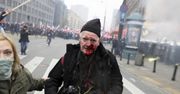 O 2 w nocy przyszła policja. Relacja postrzelonego fotoreportera