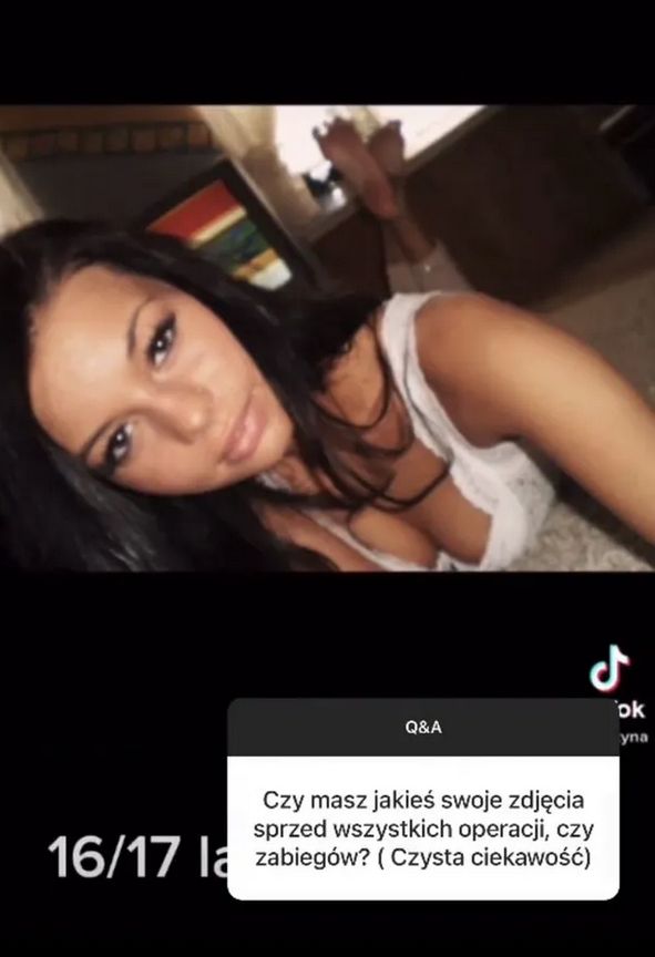 Tak Justyna Gradek wyglądała przed operacjami plastycznymi