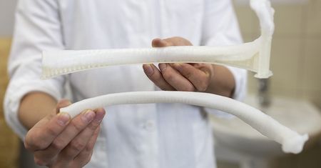 Udane wszczepienie implantu żebra z polskiej drukarki 3D
