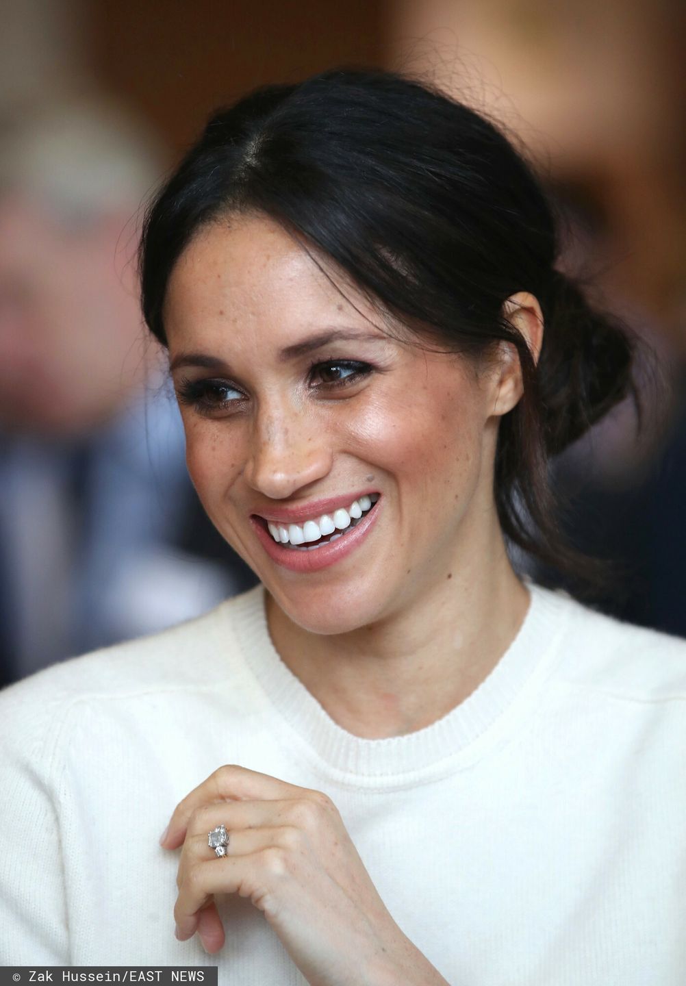 Meghan Markle poprawiła uzębienie