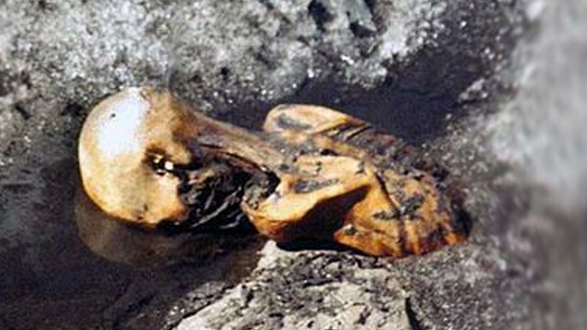 Ötzi to przydomek człowieka, który zmarł około 5200 lat temu