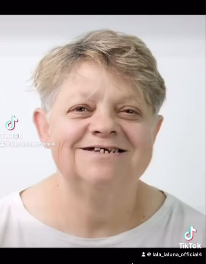 Mama Laluny pochwaliła się tureckim uzębieniem