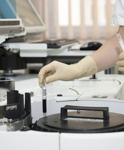 Katowice. Nowe narzędzie do walki z koronawirusem