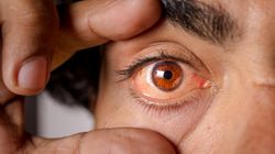 Masz problemy ze wzrokiem? To może być objaw wysokiego cholesterolu