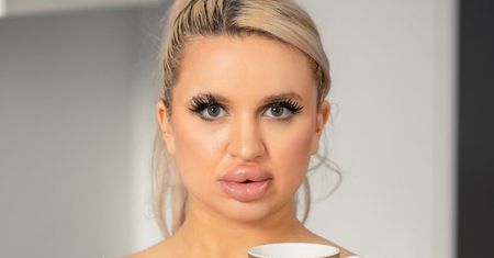 Nastolatka z największymi implantami. Wydała 100 tys. zł, by wyglądać jak lalka Barbie