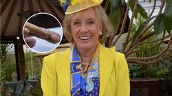 Gwiazda TV walczy z rakiem płuc. Objawy mogą pojawić się na twarzy i paznokciach