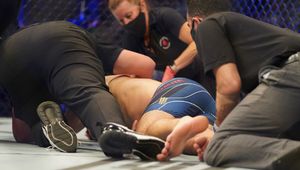 UFC 261. Weidman przeszedł operację po fatalnym złamaniu. Żona wydała oświadczenie