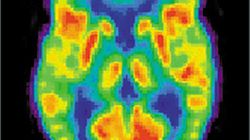 Odkryto „neurony Facebooka” 1