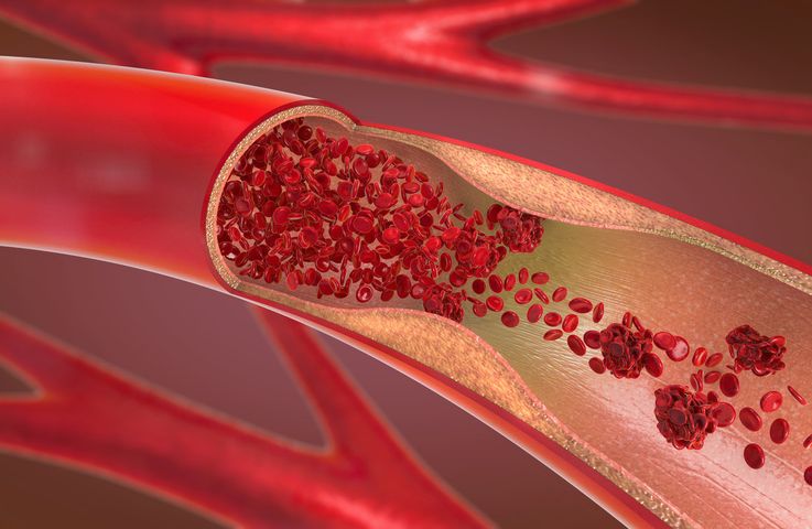 Tętnica to duże to naczynie krwionośne, które prowadzi krew z serca do narządów ciała.