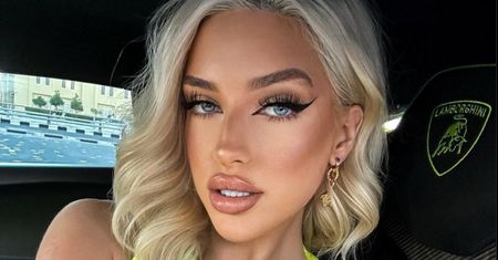 Caroline Derpienski pokazała, jak naprawdę wygląda jej cera (FOTO)