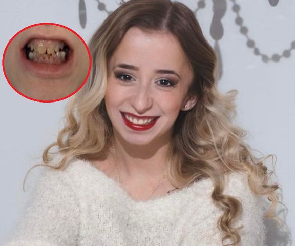 Po operacji Mihaley ma piękne zęby