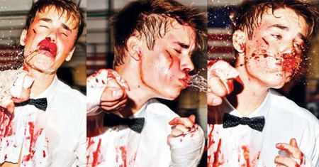 ZAKRWAWIONY, POBITY Justin Bieber! (ZDJĘCIA)