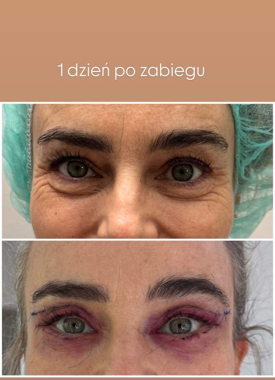 Kasia Nast