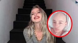 Objaw pojawiał się po wypiciu alkoholu. Rak był w trzecim stadium