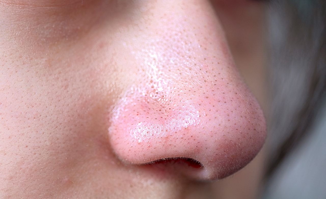 It works like a blackhead vacuum. A gelatin mask is an absolute hit.