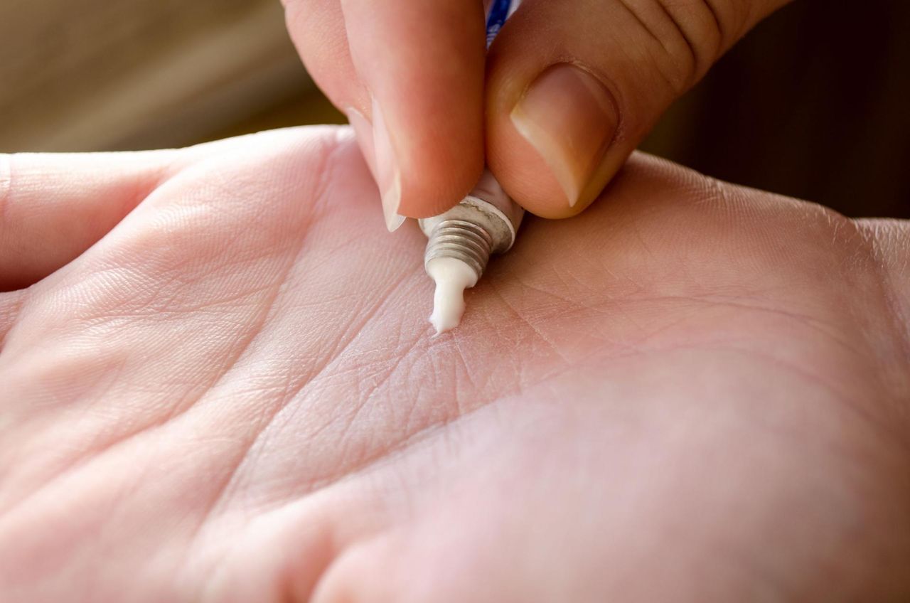 Maść z witaminą A - jak wpływa na skórę witamina A zawarta w kosmetyku, czy witamina A działa na trądzik?