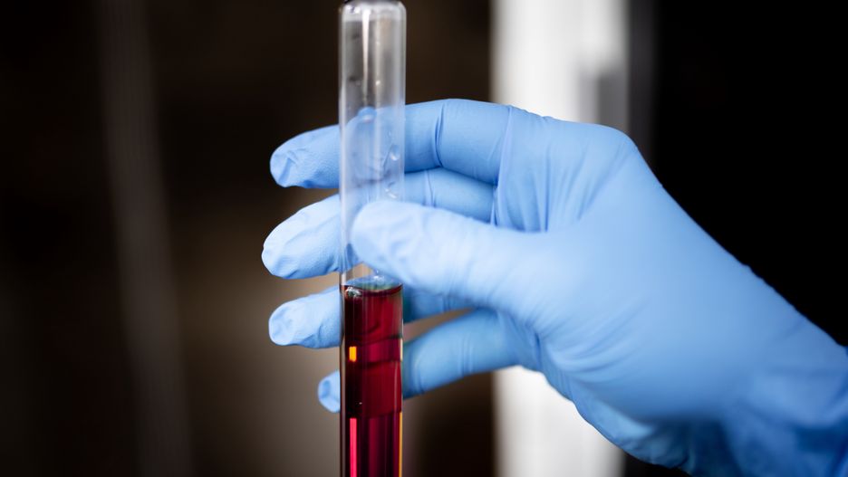 koronawirus, covid 19, laboratorium, lek, laborant, testy, pandemia, epidemia, wymaz, szczepionka, leczenie, sanepid, medyk, karetka, morfologia, probówka, chemia, naukowcy, badania, medyczne, eksperyment, doktor, ciecz, chemik, biologia, naukowy, biotechnologia, analiza, pipeta, lateks, strój ochronny, strzykawka, izolowany, szczepienia, zdrowie, szpital, narkotyk, grypa, choroba