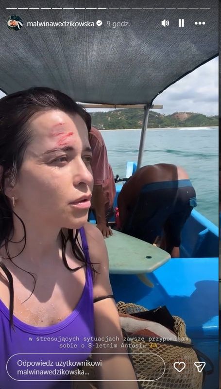 Malwina Wędzikowska miała wypadek na wakacjach 