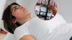 Guz mózgu. Naukowcy wskazują cztery możliwe objawy