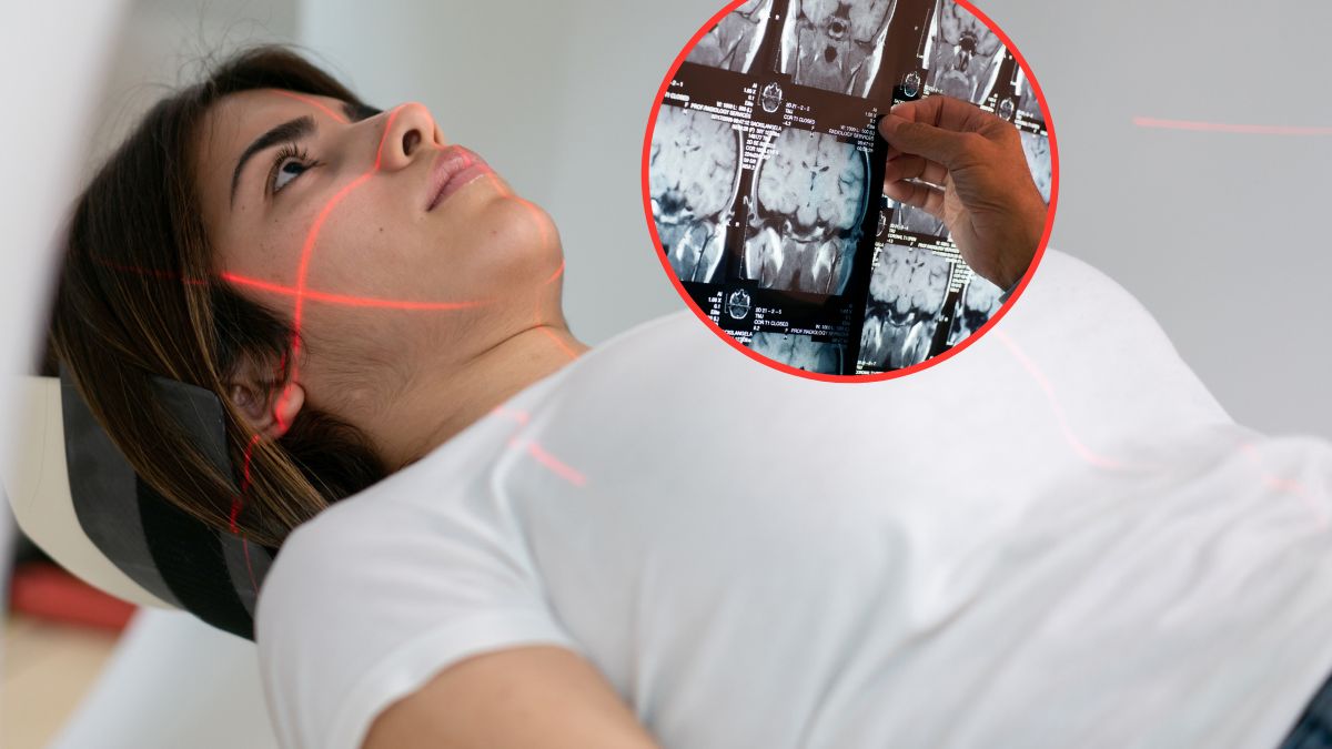 Jakie objawy mogą dawać nowotwory mózgu?