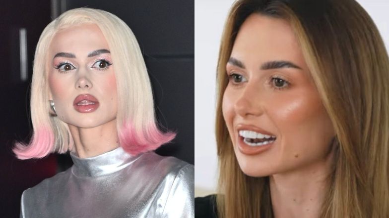 Nowe zęby Wersow wywołały PORUSZENIE w sieci