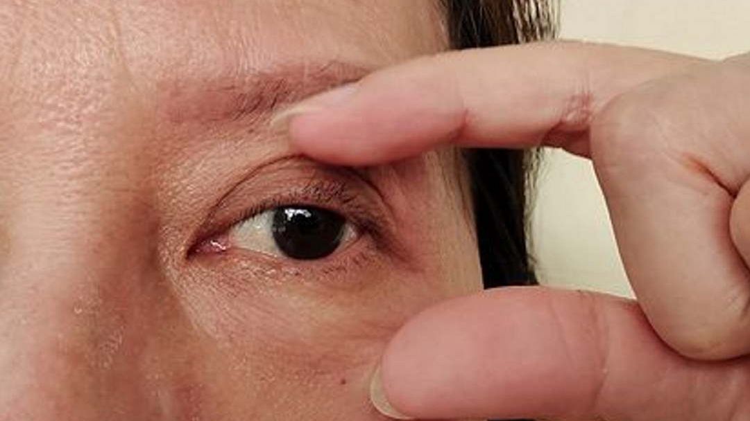 Zauważyłeś te objawy? Uważaj