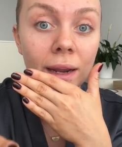 Wycisnęła półtorarocznego pryszcza. Skutki były opłakane