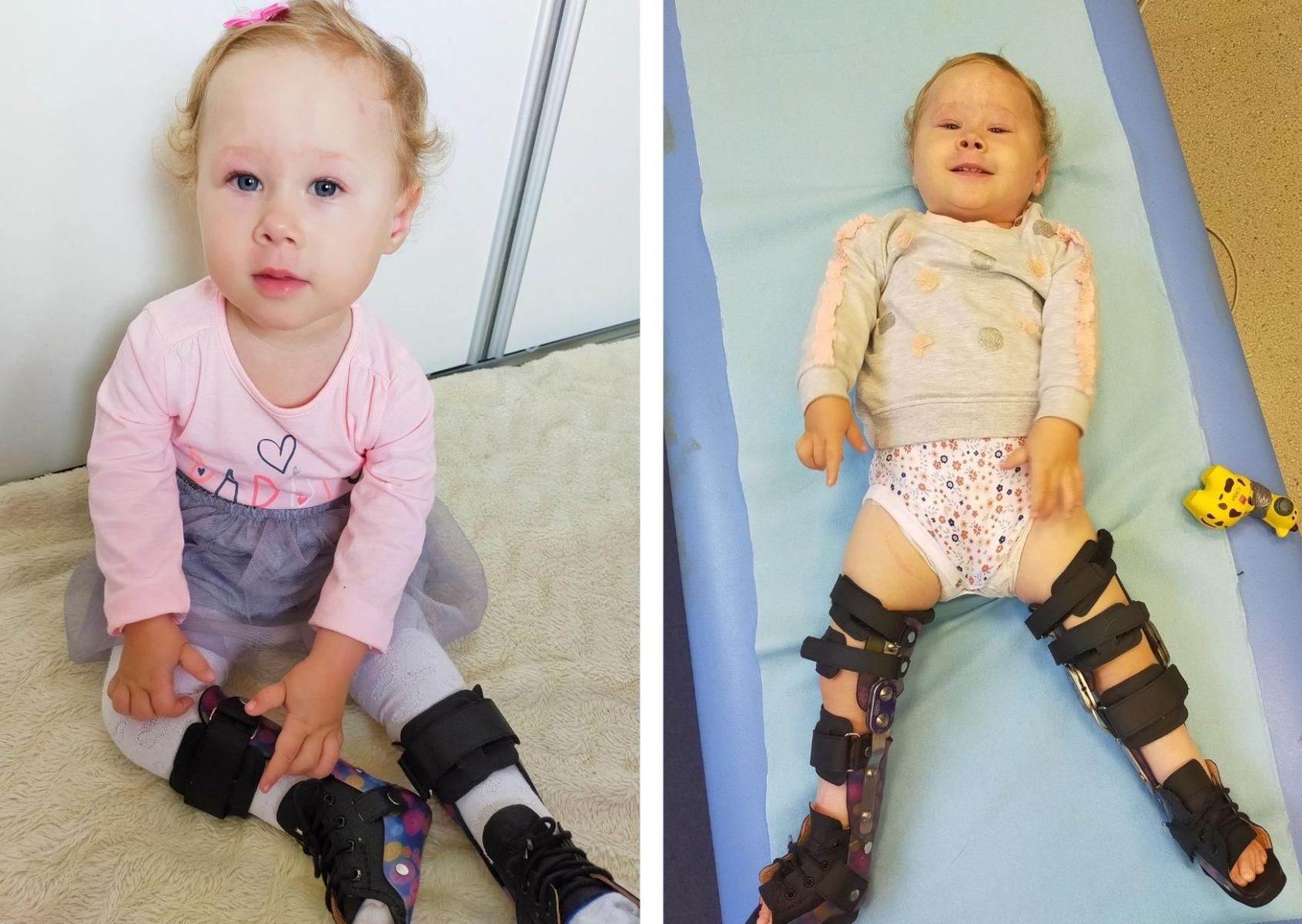 Julka potrzebuje kolejnych operacji