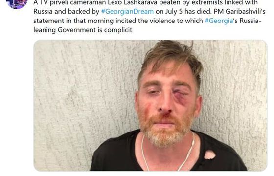 Zmarł gruziński operator pobity przed Paradą Równości