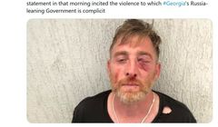 Zmarł gruziński operator pobity przed Paradą Równości