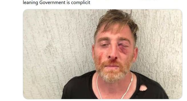 Zmarł gruziński operator pobity przed Paradą Równości