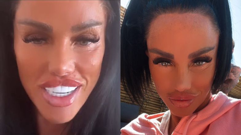 Twarz Katie Price powoli staje się nieruchoma