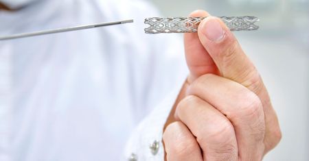 Stent - rodzaje, wskazania, przeciwwskazania, przebieg zabiegu, powikłania