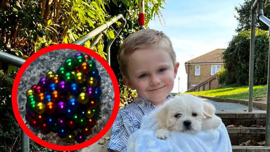 Chłopiec połknął magnesy, które dostał od mamy. "Zgrupowały się w jego żołądku"