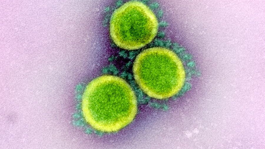 fot. Wikimedia Commons, National Institute of Allergy and Infectious Diseases (NIAID)/ CC BY 2.0. Na zdjęciu obraz z transmisyjnego mikroskopu elektronowego wirusa SARS-CoV-2,
