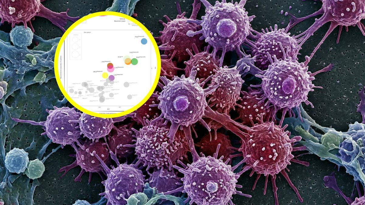 Powstał algorytm AI przewidujący ryzyko przerzutów raka