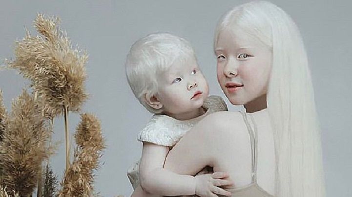 Siostry albinoski podbijają media społecznościowe. Internauci nie wierzą, że są prawdziwe