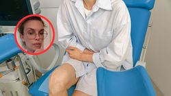 Wstydliwy skutek leku? Ekspertka o "Ozempic vulva"