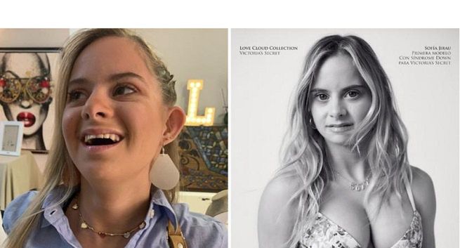 Modelka z zespołem Downa w kampanii Victoria’s Secret