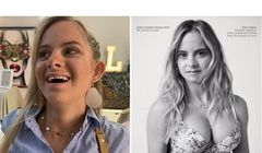 Modelka z zespołem Downa w kampanii Victoria’s Secret