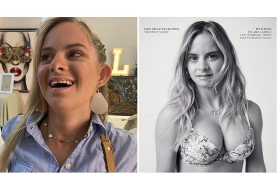 Modelka z zespołem Downa w kampanii Victoria’s Secret